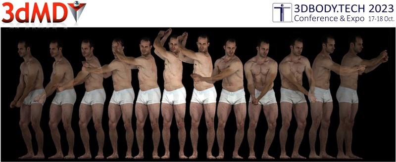 3dMD