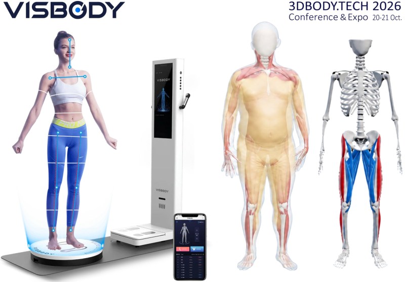 Visbody Intelligent Technology